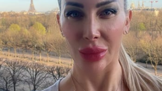 Хорър! Ужасно акне напъпли лицето на Антония Петрова (А какво стана с „безупречния й вид“? – ФОТО)