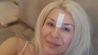 Невероятно, но факт! Гала изглажда бръчките с тиксо! Резултатът е впечатляващ (Вижте повече ТУК)