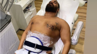 Азис топи тлъстини с липосукция