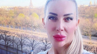 Тоца се окепази с филъри, лицето й стана на бабуни