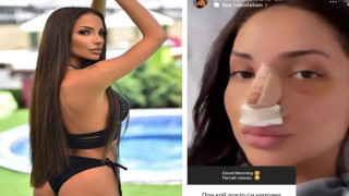 Мис Силикон си кръцна носа при доктора на Преслава