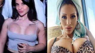 Ивка Бейбе не е единствената жертва на пишман хирурга! Вижте кои други родни звезди са със силикон до шията (СНИМКИ)