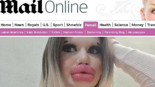 Дейли мейл гръмна: Българката с най-големи устни в света пред ЗАПЛАХА от некроза! СНИМКИ