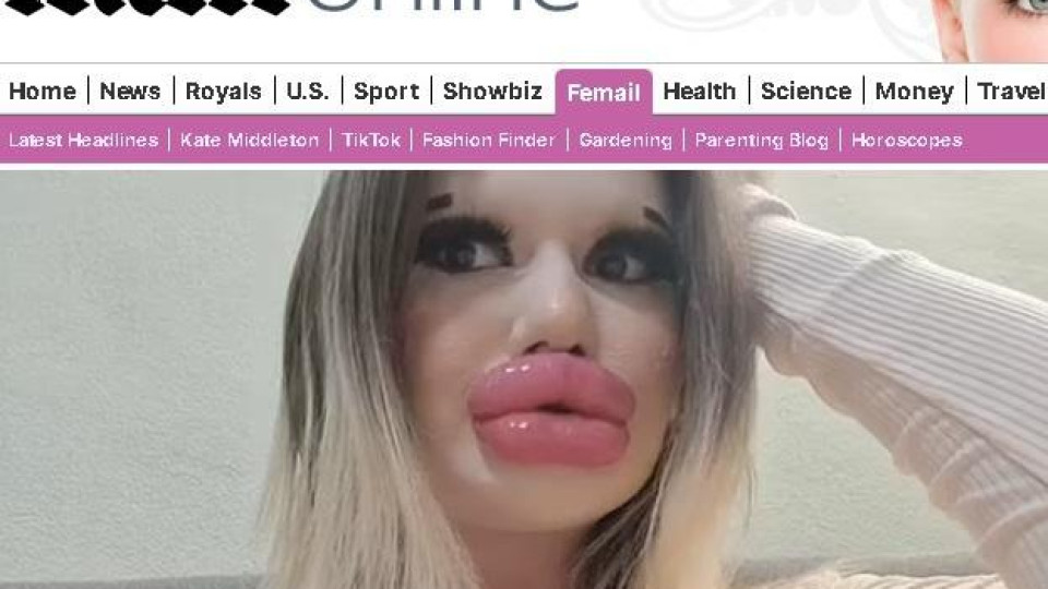 Дейли мейл гръмна: Българката с най-големи устни в света пред ЗАПЛАХА от некроза! СНИМКИ