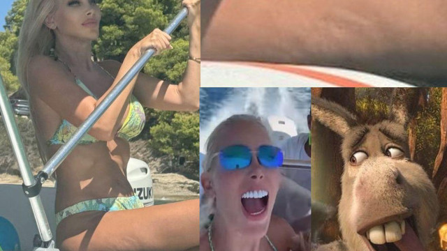 Не знаем кое ни стресира повече – огромното количество целулит