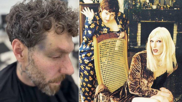 Продължават да тормозят пребития стилист Борислав Сапунджиев
Нападнаха ме за първи