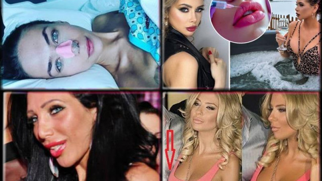 Ботокс стана сред най търсените думи в България в последните дни
И