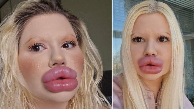 За отнемане на лиценз и солидна глоба за незаконни интервенции