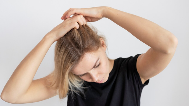 Здравето на скалпа често е подценявано докато не се сблъскаме