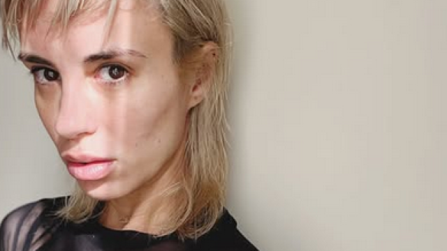 В разгара на скандала с нелегалното поставяне на опасен ботокс