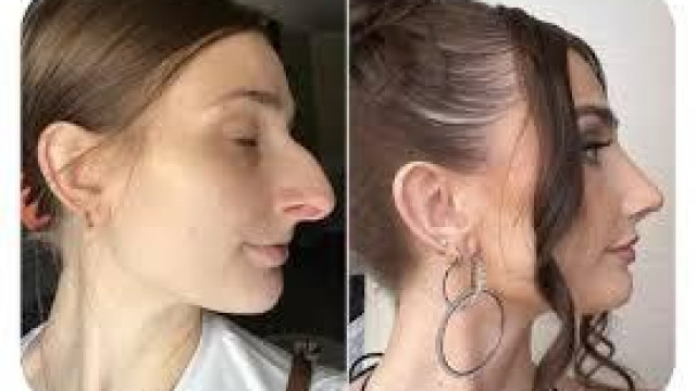 Интернет е пълен с жени дали куп пари за операции