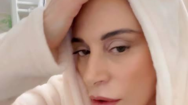 Вярно е че имам твърде много ботокс но ето тук