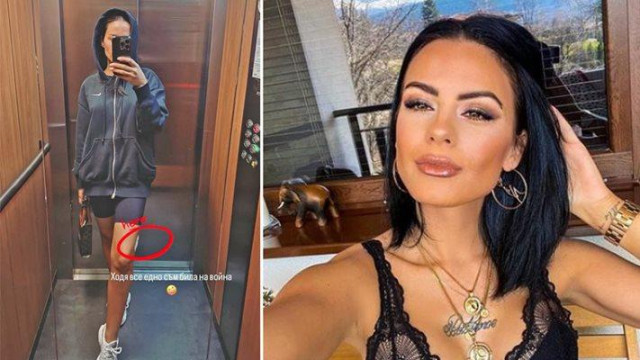 Лека контузия на крака получи жената на Криско Цветелина