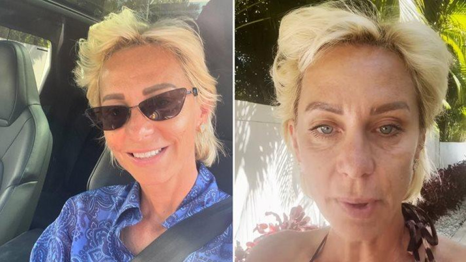  Нана още се бори с провалите от ботокса 