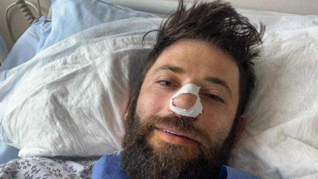 Сериозна операция на носа претърпя тези дни Станислав Яневски Актьорът