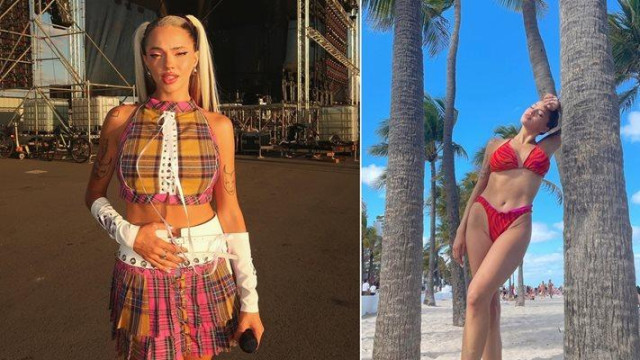 Варненската певица Дара сподели че се контузила като е напра вила