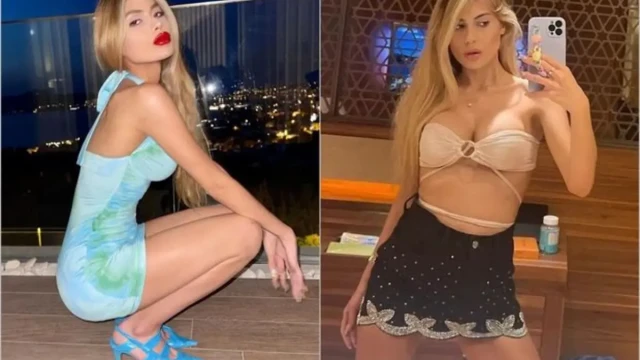 Спаружена като мумуя риалити звезда умира от анорексия тежаща едва