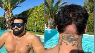 Азис със стряскаща снимка на опадалата си коса
