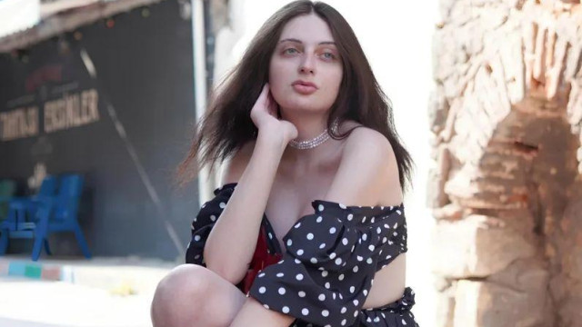 Транссексуалната Петра си направи нов нос Операцията на горнооряховчанката е