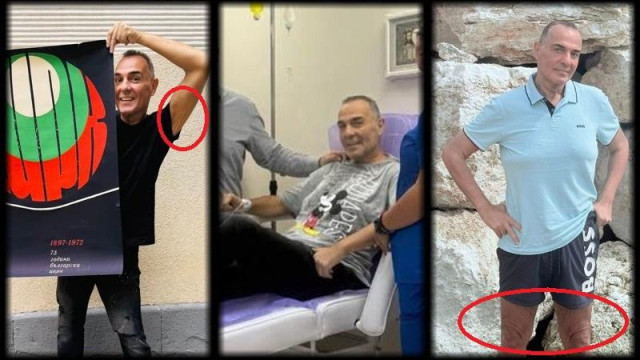 Драго Драганов вече започва да плаши с драстичното си отслабване