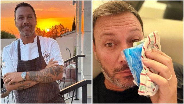 Посиниха ми окото по време на мач призна България Днес