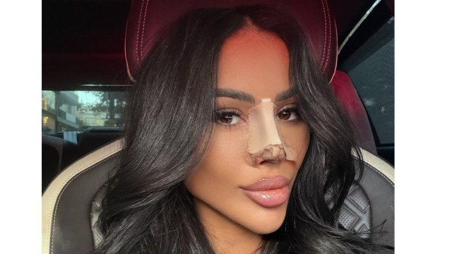 Гаджето на Благой Георгиев Мария Луиза легна под ножа с