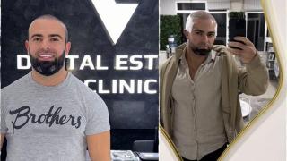 Ричи Тъпото се похвали с нова коса, нови зъби, ще слага и ботокс