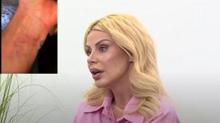 Светлана Василева показа СИНИНИТЕ от побоя снощи! (СНИМКИ)