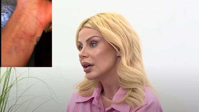 Плеймейтката Светлана Василева показа физическите следи от снощната разправия с