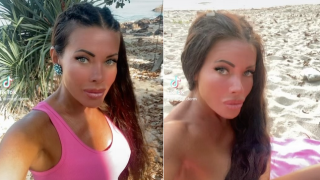 Изрязаха половината черен дроб на Меги Дерм (ВИДЕО)