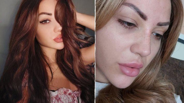 Ужилване едва не убило Галена ден преди да влезе в