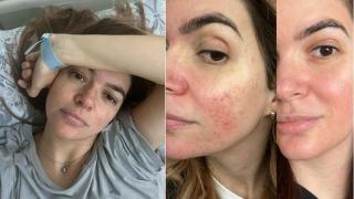 Розацеята на  Ива Софиянска се обостри