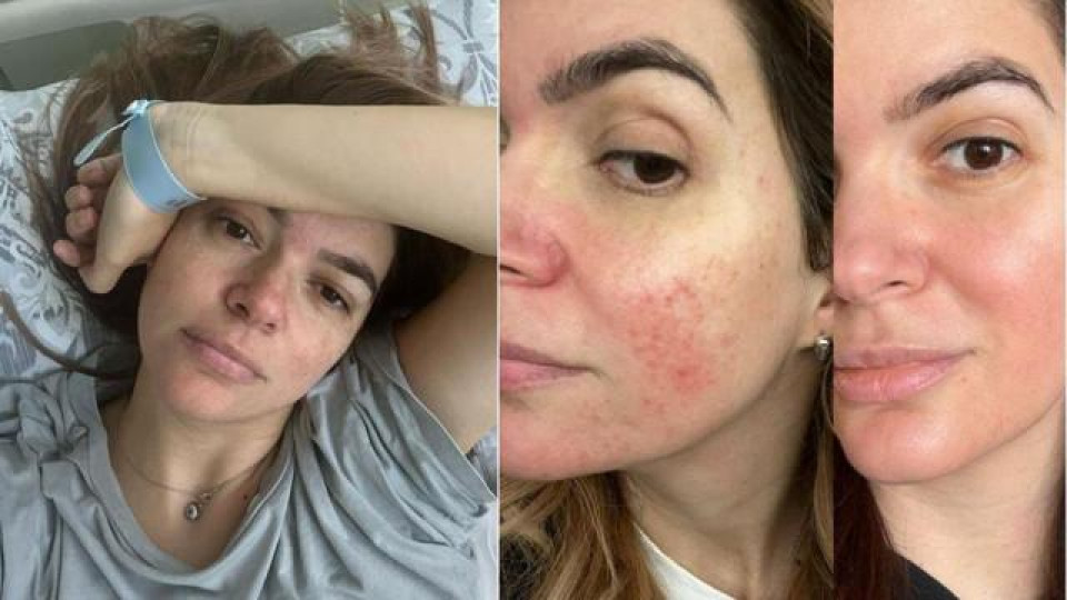 Розацеята на  Ива Софиянска се обостри