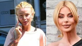 Светлана Василева с поредната лъжа: Не съм се била с мъжа си! (А от какво са синините?)