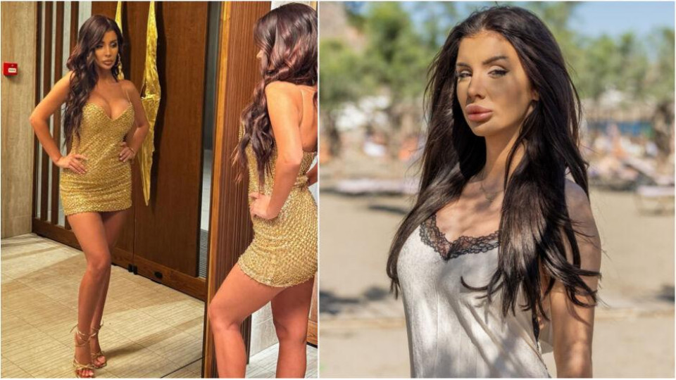 Габи от „Ергенът“: Качих и свалих 10 кг за по-малко от година заради операция