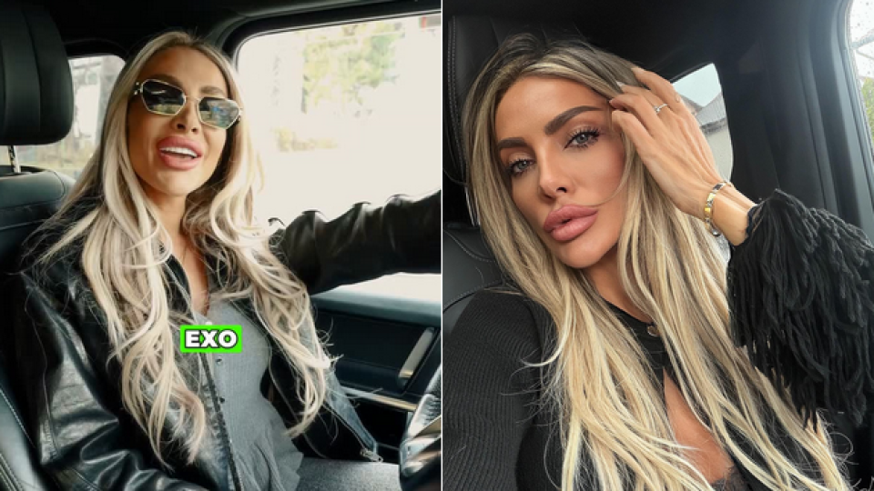 ШОК за феновете: Златка Райкова остана без челюсти