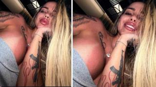 От тази гледка боли! Бомбите на Сузанита изгоряха зверски