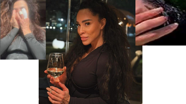 Драмата с Маги Сидерова: Присадиха нов пръст на ръката й 