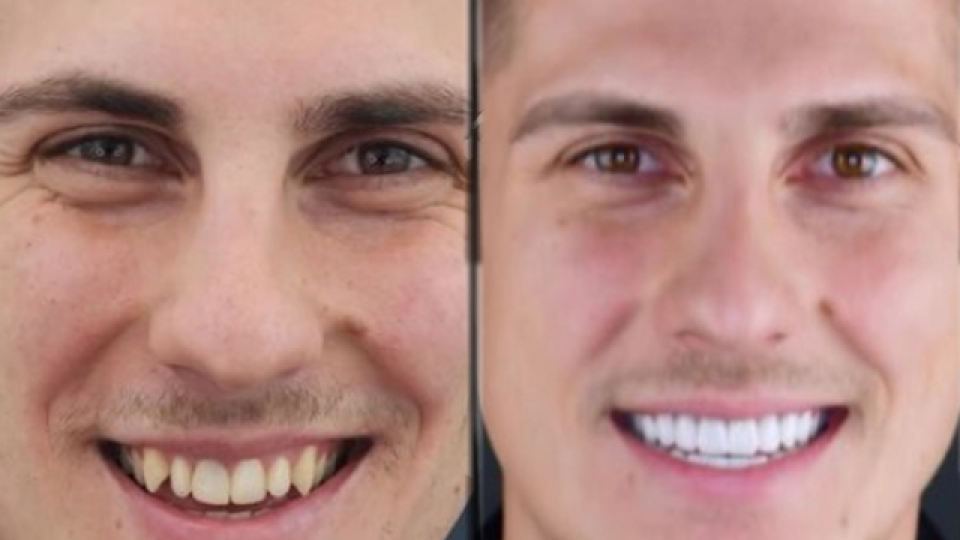 Петър Данов с бижу на зъбите