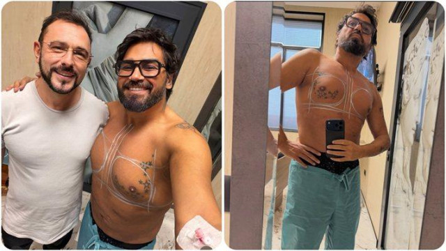 Азис обяви че си е поставил мъжки гръдни импланти и