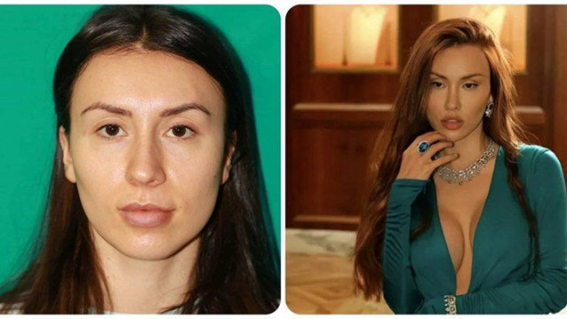 Имах 4 пирона в главата за да си опъна кожата