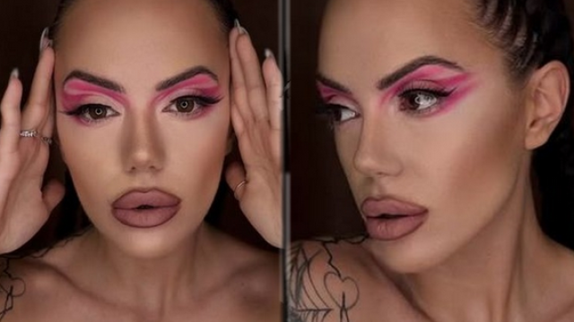 Ергенката Анна-Мария: Витилигото не ме притеснява, харесва ми да съм петниста хиена!