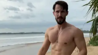 Наум Шопов  си присади коса