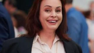 Мариана Векилска се тунингова с ботокс и филъри!
